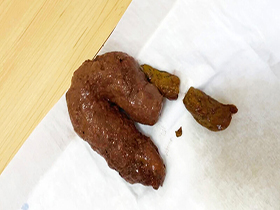 配信中に脱糞事故で覚醒！　笑顔が素敵な九州弁娘の糞まみれメッシーSEX　馬場のん　サンプル画像06